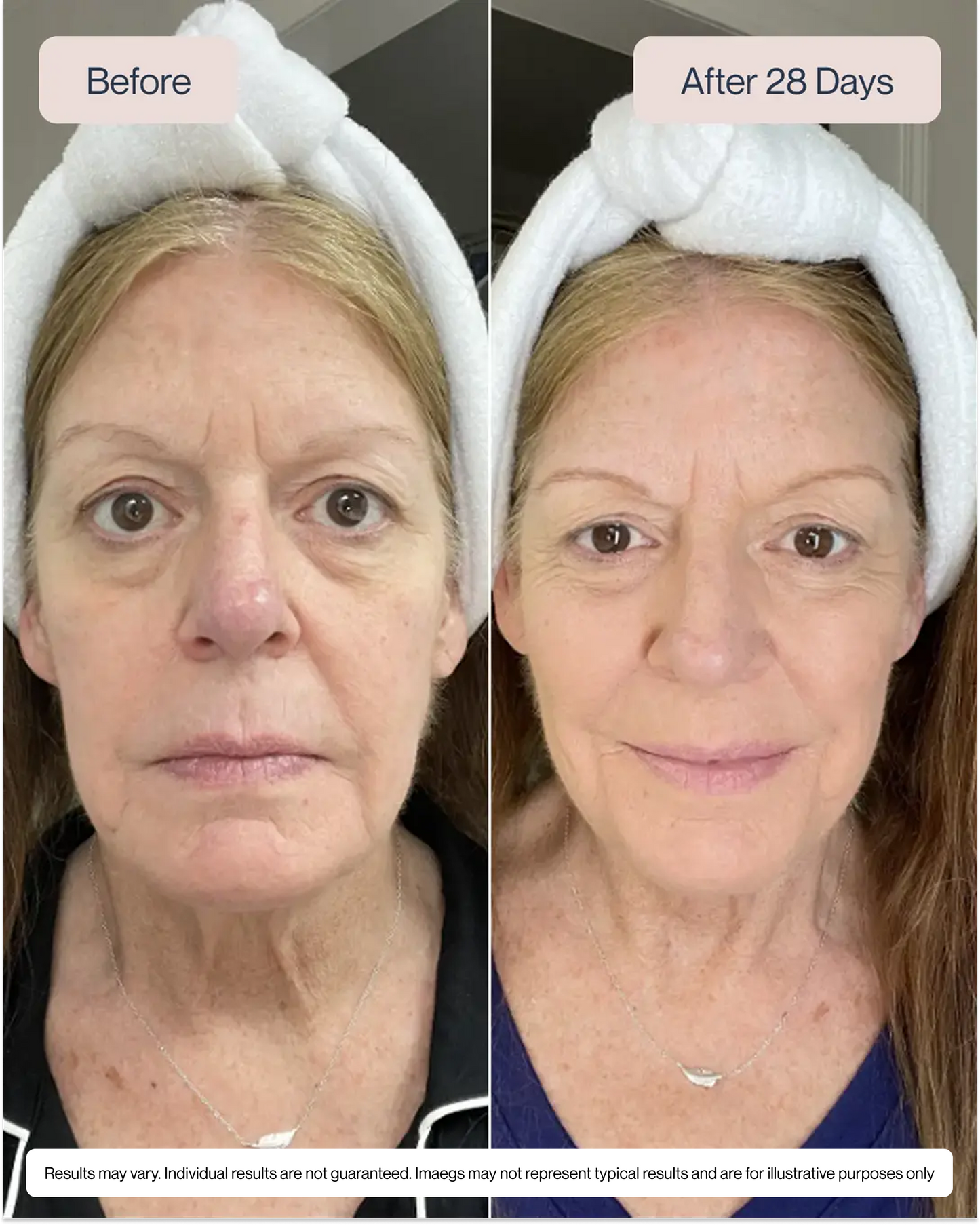 Swiss Niacinamide Serum
