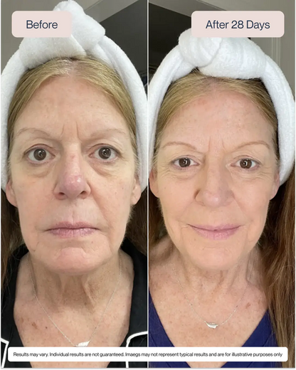 Swiss Niacinamide Serum