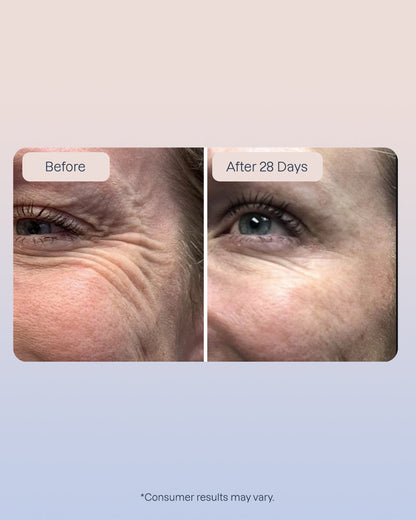 3 Golden Retinol Eye Serum