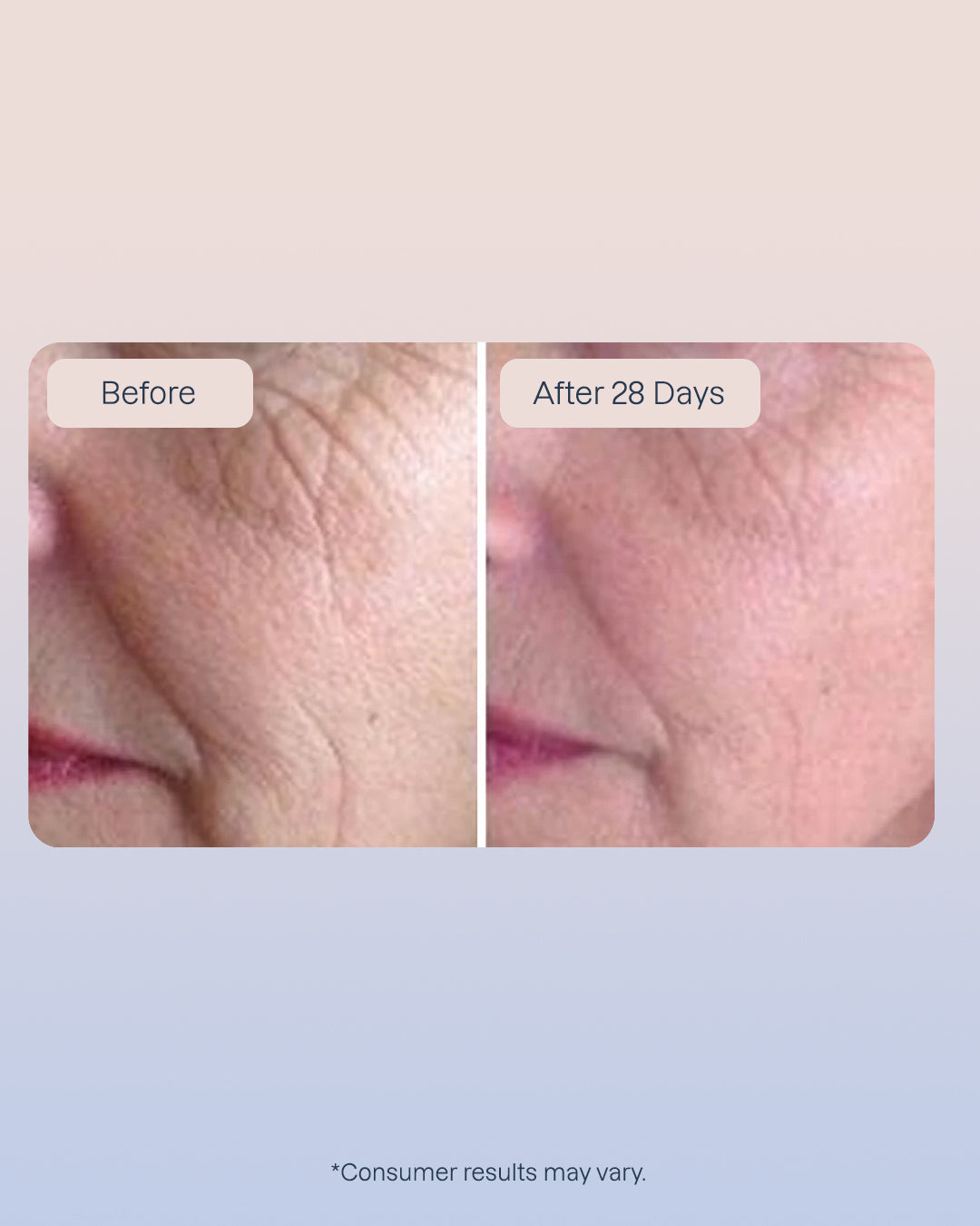 3 Golden Retinol Eye Serum