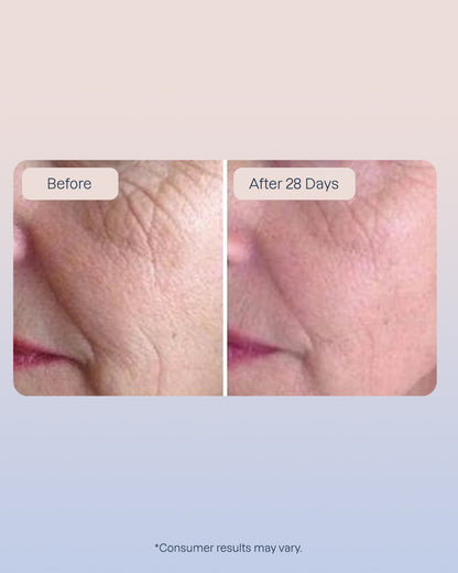 3 Golden Retinol Eye Serum